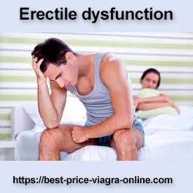 Erectile dysfunction: Which doctor helps?